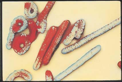 Ebola virus particles
