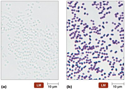 Comparison of unstained and stained bacterial cells under light microscopy