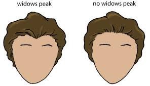 Diagram showing widow's peak and no widow's peak hairlines