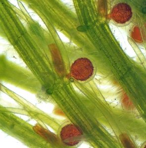 Microscopic image of charophyte algae