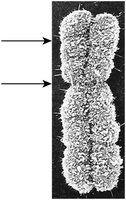 Micrograph of a duplicated human chromosome with labeled chromatids and centromere