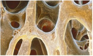 Healthy spongy bone tissue