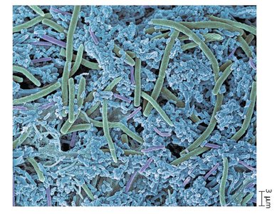 Dental plaque as a biofilm