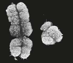X and Y chromosomes