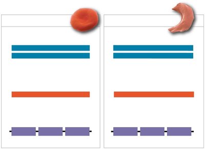 Comparison of wild-type and sickle-cell hemoglobin DNA and protein