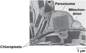 TEM of peroxisome, mitochondrion, and chloroplast