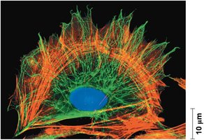Fluorescence image of cytoskeleton