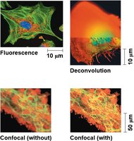 Fluorescence, deconvolution, and confocal microscopy images