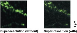 Super-resolution microscopy comparison