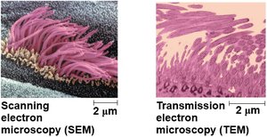 SEM and TEM images comparison