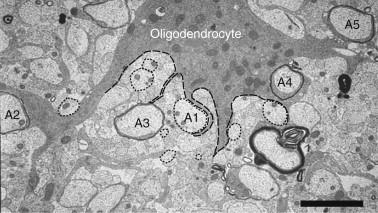 Schwann cell and myelin sheath electron micrograph