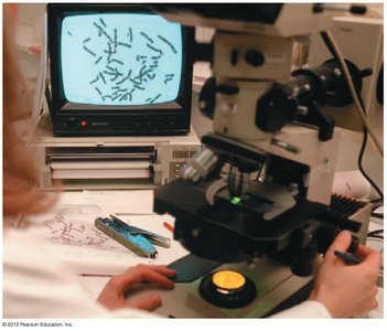 Steps in preparing a karyotype