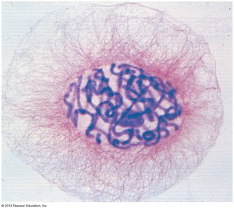Eukaryotic chromatin in the nucleus