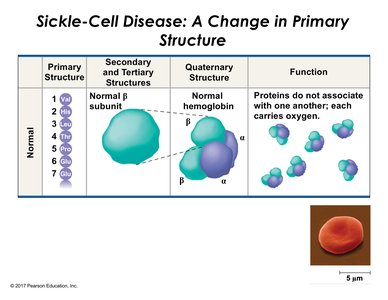 Sickle-Cell Disease: Normal Hemoglobin