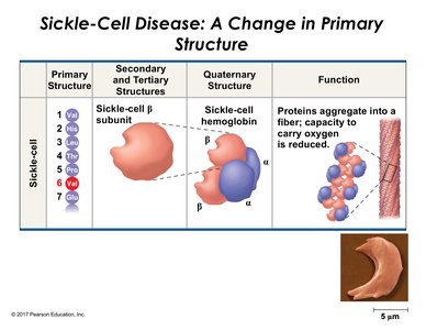 Sickle-Cell Disease: Sickle Hemoglobin