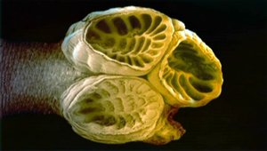 Tapeworm scolex