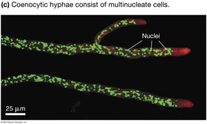 Hyphae divided by septa and coenocytic hyphae