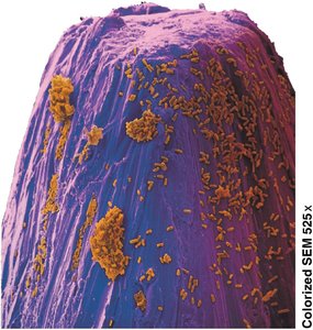 Bacteria on the point of a pin