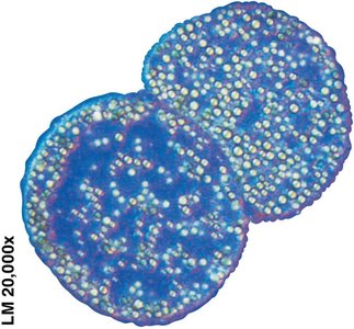 Thiomargarita namibiensis, a proteobacterium