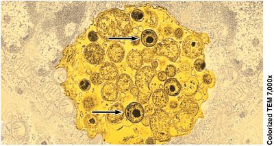 Chlamydia trachomatis inside animal cell