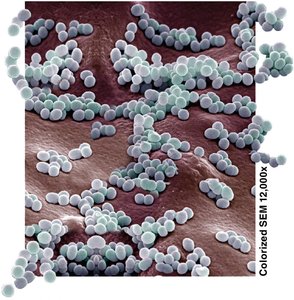 Staphylococcus aureus producing exotoxins