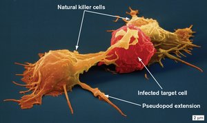 Natural killer cells attacking infected cell