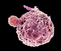 Macrophage engulfing bacteria