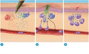 Diagram of inflammatory response process