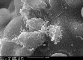Vibrio cholerae colonizing intestine