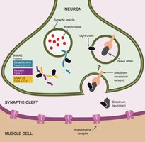 Disrupted neuromuscular signaling by botulinum toxin