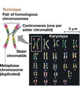 Homologous chromosomes and karyotype