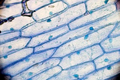 Microscopic image of plant cells showing cell walls and nuclei