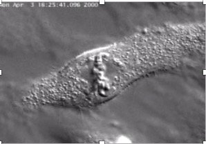Prokaryotic cell division
