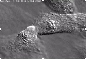 Chromosome segregation