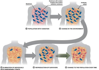Antibiotic resistance in bacteria