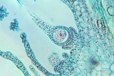 Microscopic image of an archegonium