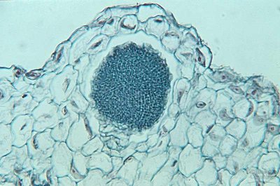 Microscopic image of an antheridium