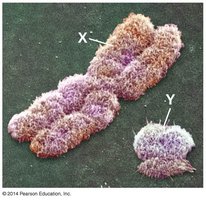 Electron micrograph of X and Y chromosomes