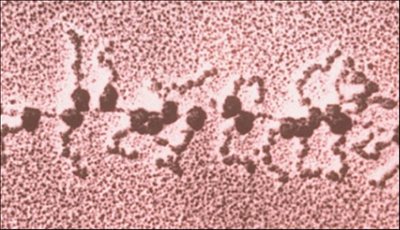 Polyribosome diagram: multiple ribosomes on mRNA