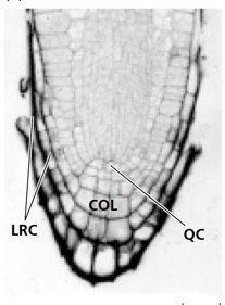 Root tip showing zones of division, elongation, and differentiation