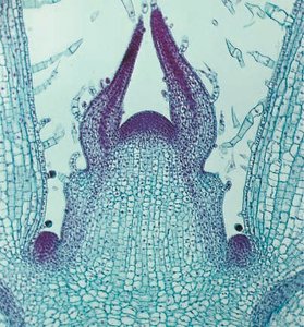 Shoot apical meristem with leaf primordia and axillary meristem