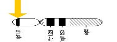 SRY gene location on Y chromosome