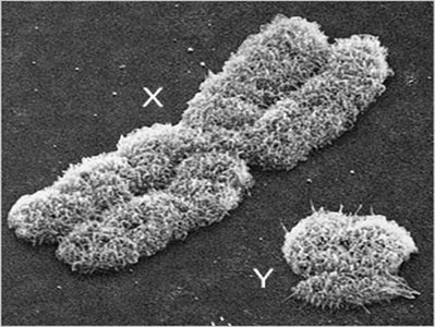 Electron micrograph of X and Y chromosomes