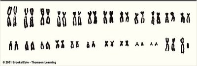 Human karyotype showing all chromosomes
