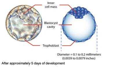 IVF-derived stem cell therapy