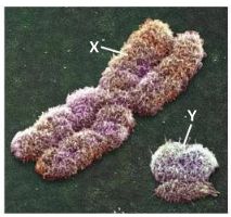 Electron micrograph of X and Y chromosomes
