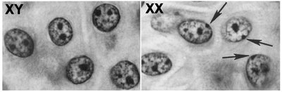 Diagram showing mosaic X inactivation in a cat