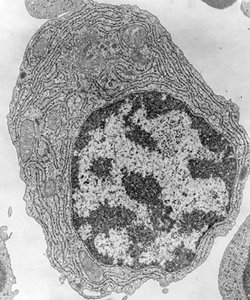 Electron micrograph of a plasma cell from bone marrow