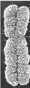 Electron micrograph of a duplicated chromosome