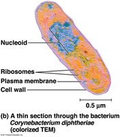 TEM of Corynebacterium diphtheriae